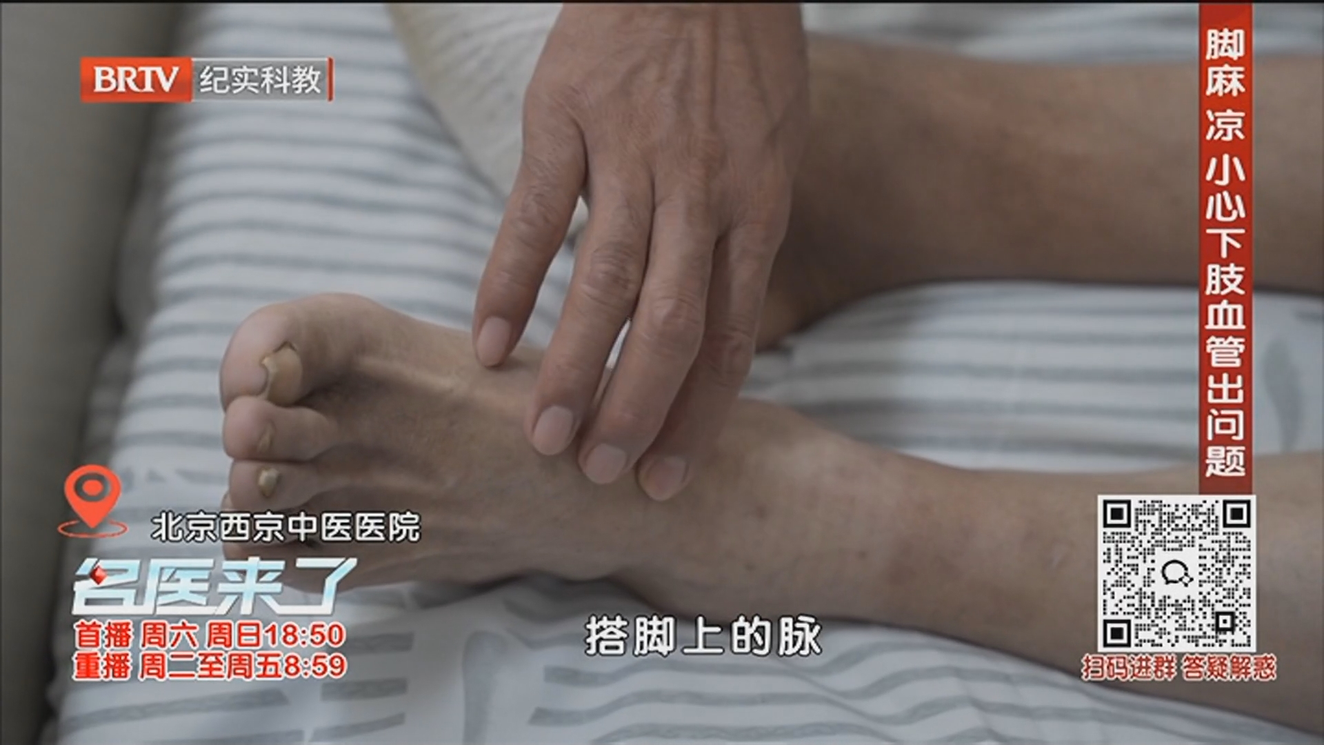 《名医来了》20260412保卫被“糖”吞噬的双足