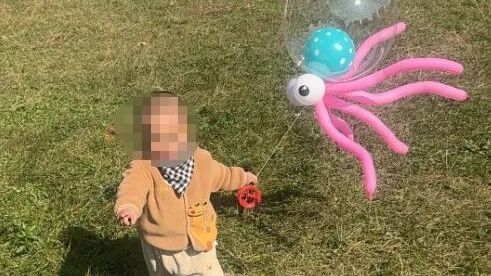 孩子手、脸都被烧伤!这种玩具千万别买 孩子手、脸都被烧伤!这种玩具千万别买