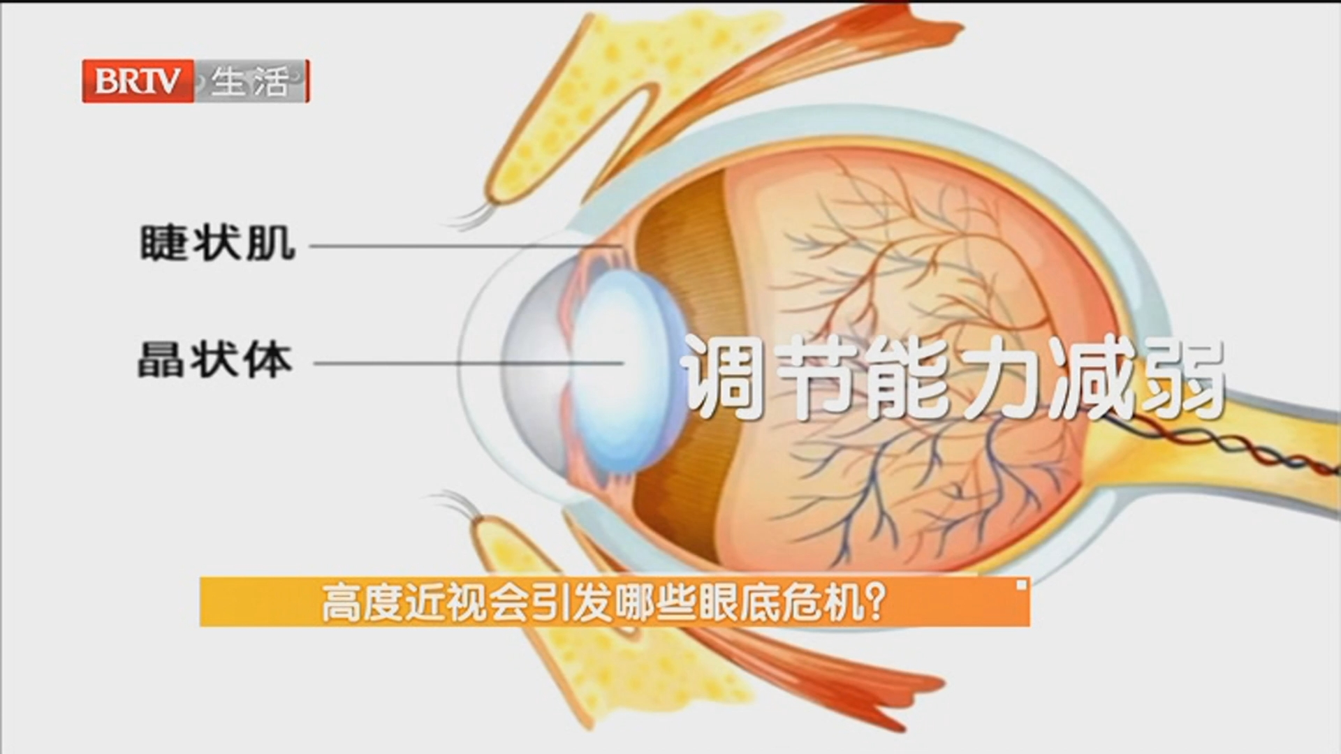 70多岁老人长期刷手机 近视高达2300度 高度近视会引发哪些眼底危机?老年人刷手机 该如何保护眼健康? 70多岁老人长期刷手机 近视高达2300度 高度近视会引发哪些眼底危机?老年人刷手机 该如何保护眼健康?