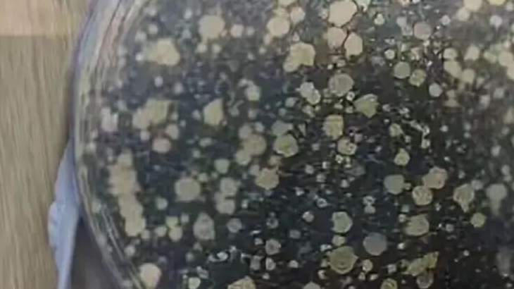 很多人天天用的东西,测出细菌上万,可能比酒店毛巾还脏 很多人天天用的东西,测出细菌上万,可能比酒店毛巾还脏