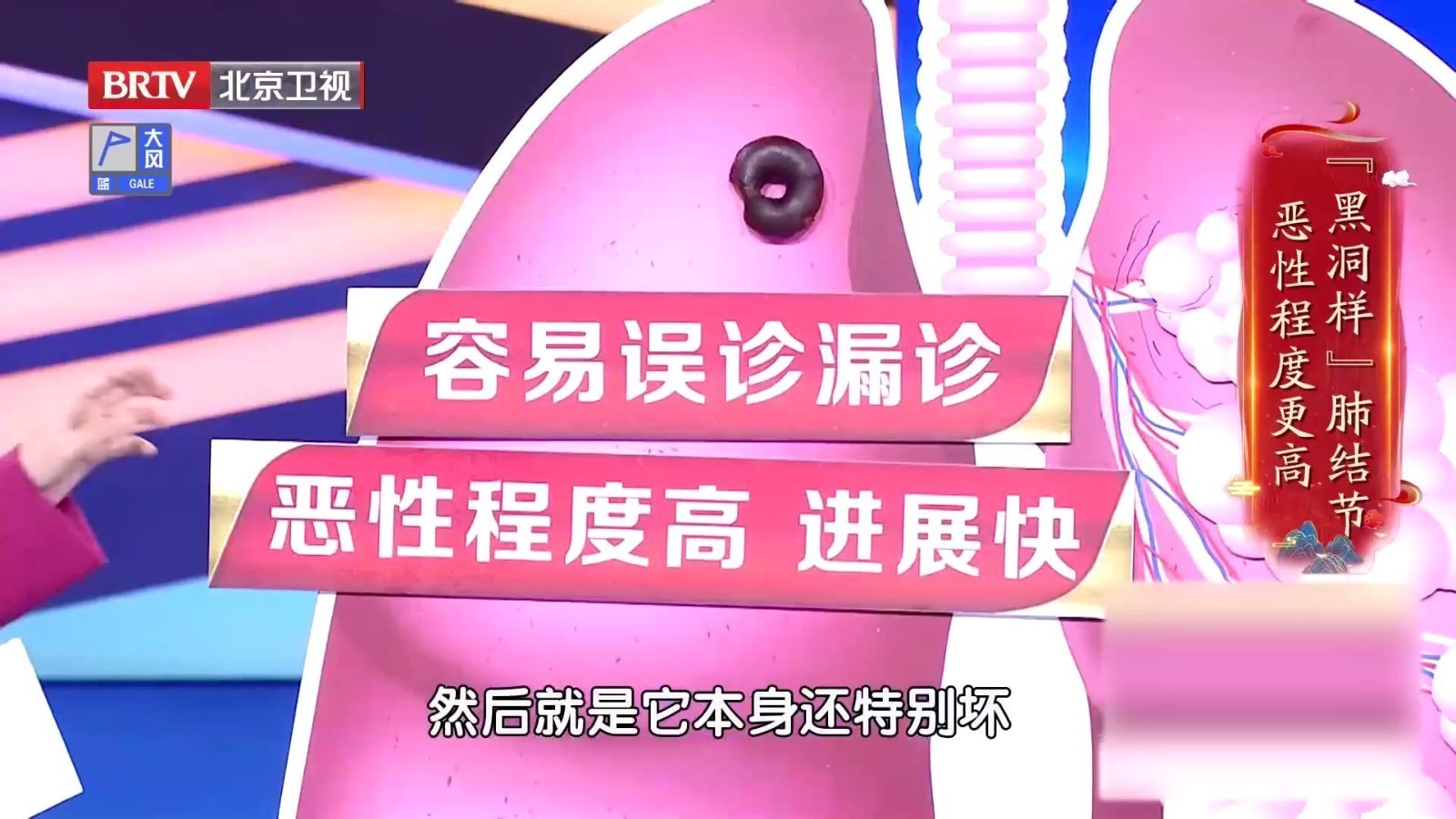 “黑洞样”肺结节容易误诊、漏诊,并且恶性程度高、进展快!_北京时间