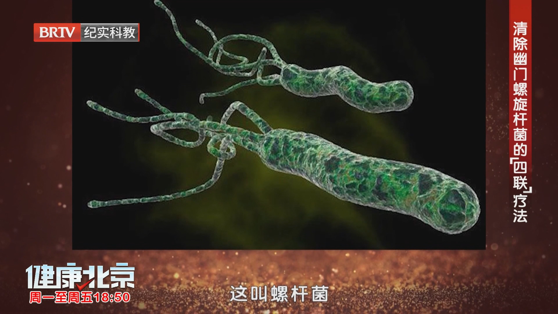 清除幽门螺旋杆菌的“四联”疗法 清除幽门螺旋杆菌的“四联”疗法