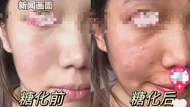 面部糖化！第一批奶皮子糖葫芦 的‘受害者’出现了