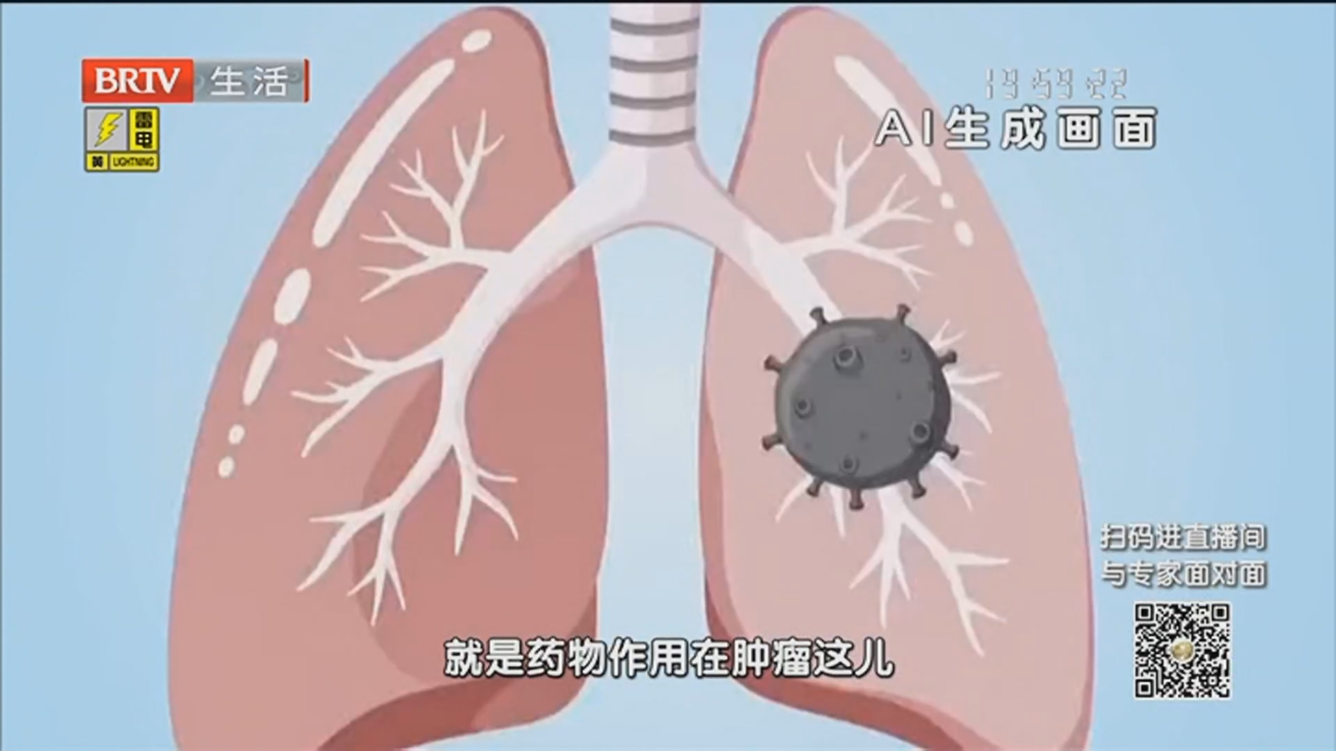 《全民健康学院》20260608联合诊疗 精准管理肺部肿瘤