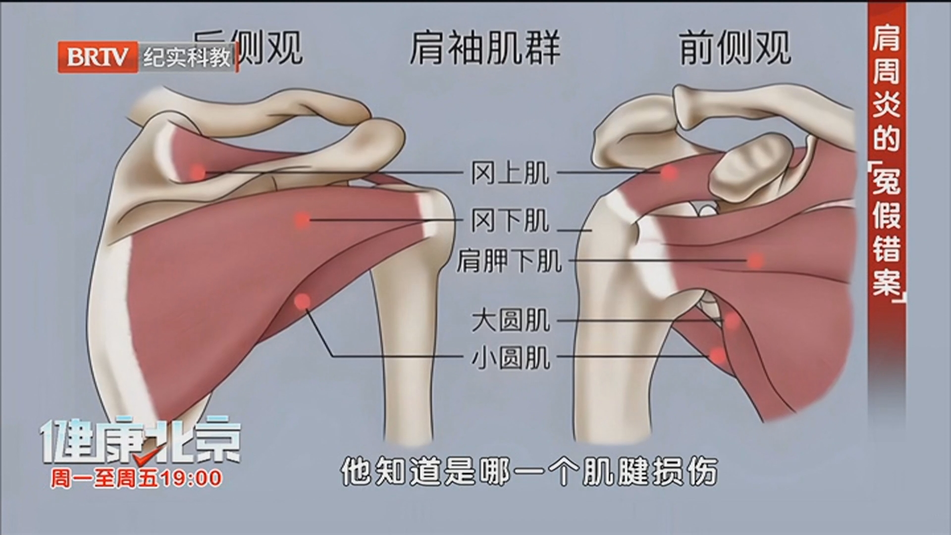 《健康北京》20251204舒针疗法 一针解锁“冻结肩” 《健康北京》20251204舒针疗法 一针解锁“冻结肩”