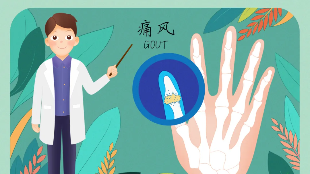 尿酸高但关节不痛,就不用管吗? 尿酸高但关节不痛,就不用管吗?