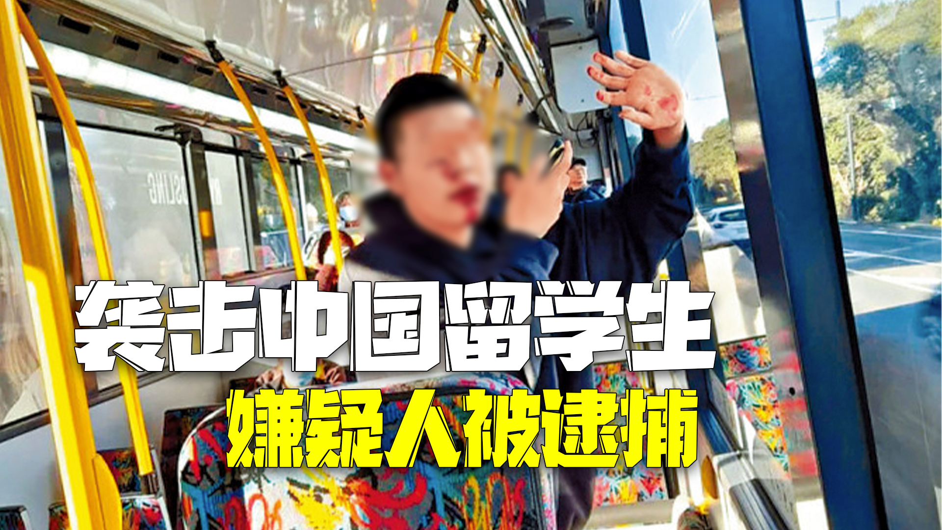 嫌疑人被逮捕！使馆通报中国留学生遇袭 将以“出于仇恨动机”罪起诉